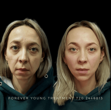 Signature Treatments