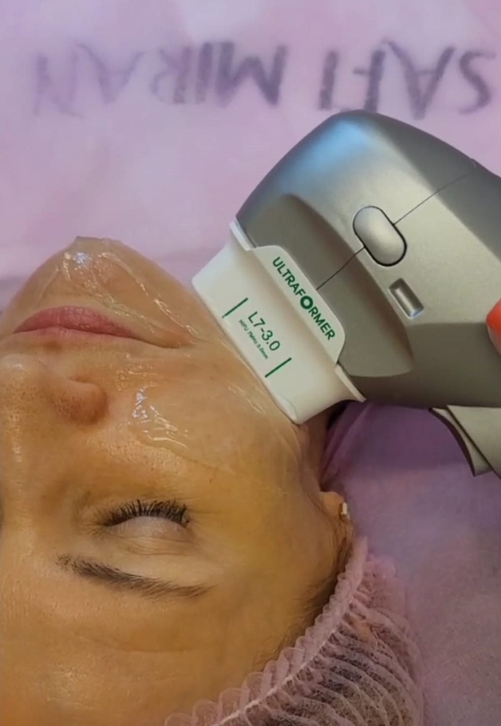 Before and after Skin Treatments